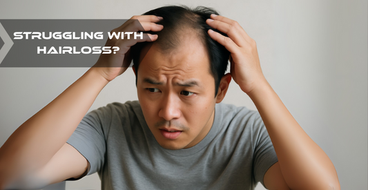 Losing Hair? Here’s What You Need to Know About Finasteride